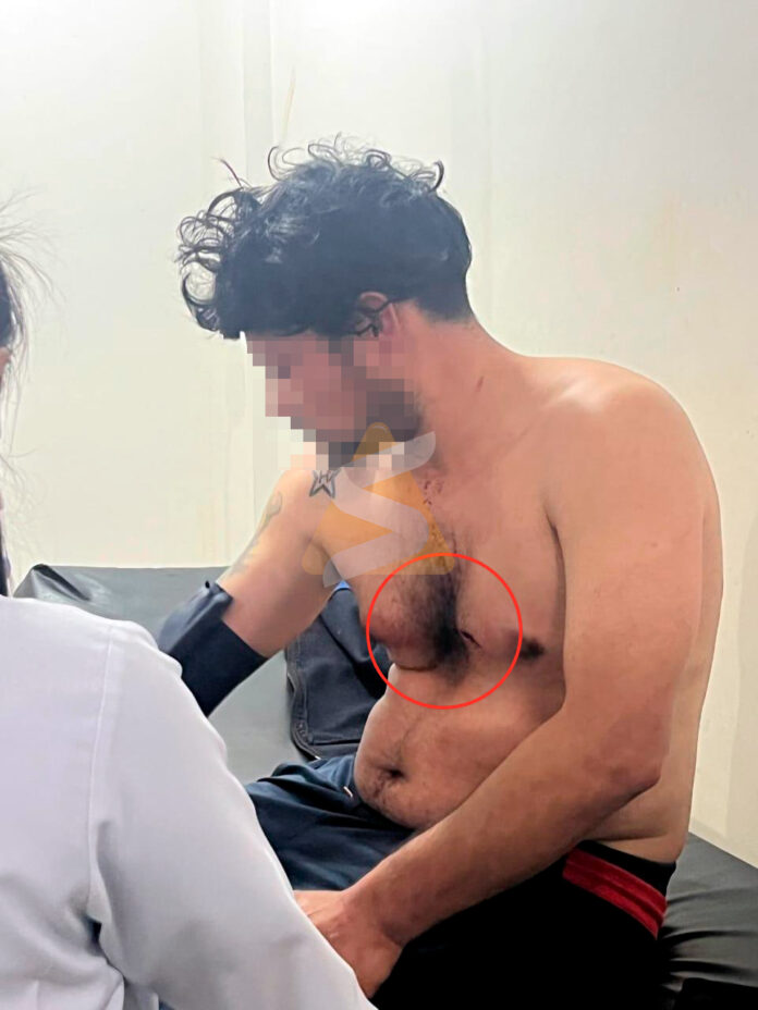 En medio de la ingesta de bebidas alcohólicas surgió una fuerte discusión y Araújo, supuestamente, tomó un machete y aplicó un corte en el pecho del joven, lado izquierdo, para luego darse a la fuga. Foto: Redacción Suceso.