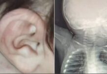 Brutal agresión a un bebé de ocho meses en Minga Guazú