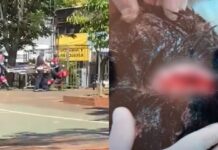 Pelea entre alumnos acaba con un adolescente herido en Encarnación Uno de los estudiantes sufrió una herida a la altura de la cabeza. Foto: Gentileza.