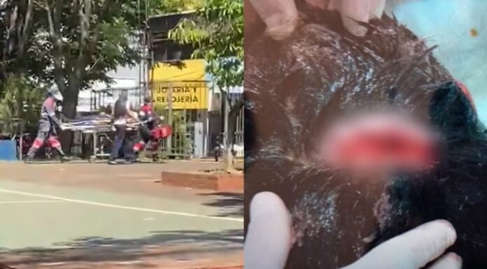 Uno de los estudiantes sufrió una herida a la altura de la cabeza. Foto: Gentileza. Uno de los estudiantes sufrió una herida a la altura de la cabeza. Foto: Gentileza.